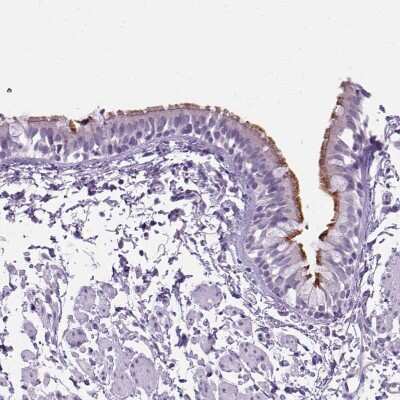 Immunohistochemistry-Paraffin: ARMC4 Antibody [NBP1-84175]