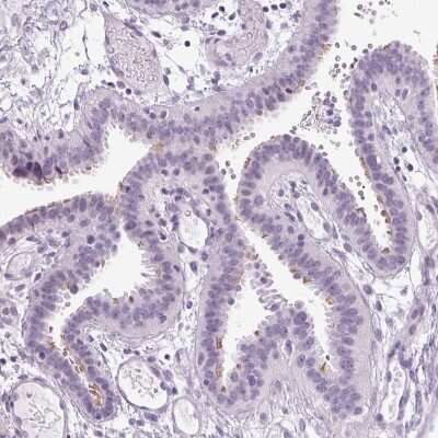 Immunohistochemistry-Paraffin: ARMC4 Antibody [NBP1-84175]