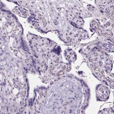 Immunohistochemistry-Paraffin: ARMC4 Antibody [NBP1-84175]