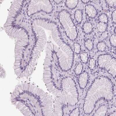 Immunohistochemistry-Paraffin: ARMC4 Antibody [NBP1-84175]