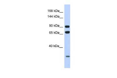 Western Blot: ARMC4 Antibody [NBP2-84460]