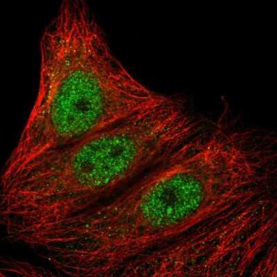 Immunocytochemistry/ Immunofluorescence: ARMC5 Antibody [NBP2-56232]