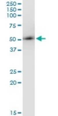 Immunoprecipitation: ARMC6 Antibody (2H8) [H00093436-M03]