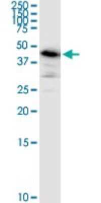 Western Blot: ARMC6 Antibody (2H8) [H00093436-M03]