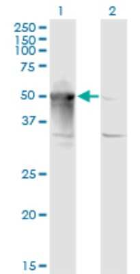 Western Blot: ARMC6 Antibody (2H8) [H00093436-M03]