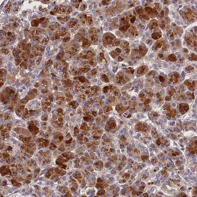 Immunohistochemistry-Paraffin: ARMC6 Antibody [NBP1-81179]