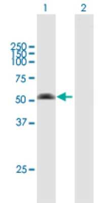 Western Blot: ARMC6 Antibody [H00093436-B01P]
