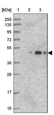 Western Blot: ARMC6 Antibody [NBP1-81179]