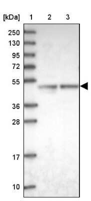 Western Blot: ARMC6 Antibody [NBP2-14317]