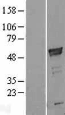 Western Blot: ARMC6 Overexpression Lysate [NBL1-07707]