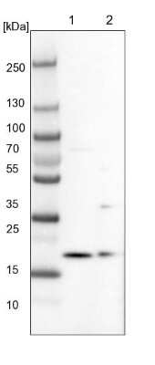 Western Blot: ARMC7 Antibody [NBP1-82129]