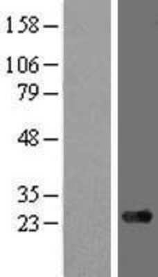 Western Blot: ARMC7 Overexpression Lysate [NBL1-07708]