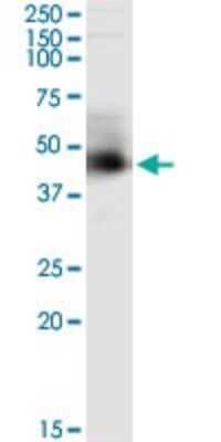 Immunoprecipitation: ARMC8 Antibody (2D9) [H00025852-M01]