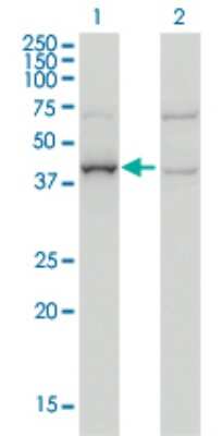 Western Blot: ARMC8 Antibody (2D9) [H00025852-M01]