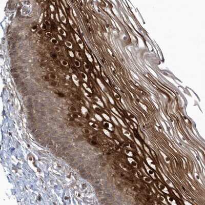 Immunohistochemistry-Paraffin: ARMC8 Antibody [NBP1-85149]