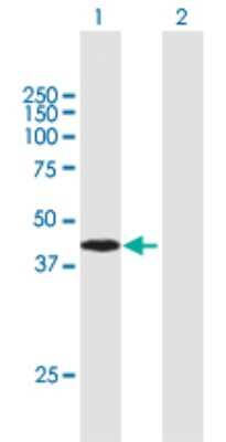 Western Blot: ARMC8 Antibody [H00025852-B01P]