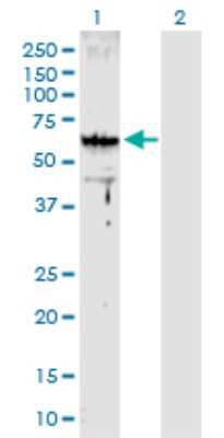 Western Blot: ARMC8 Antibody [H00025852-D01P]