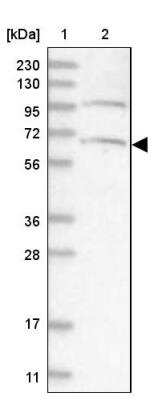 Western Blot: ARMC8 Antibody [NBP1-85149]