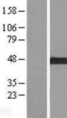 Western Blot: ARMC8 Overexpression Lysate [NBL1-07710]