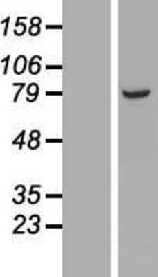 Western Blot: ARMC9 Overexpression Lysate [NBL1-07712]