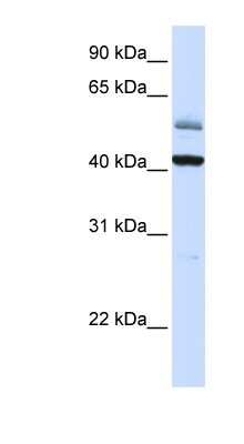 Western Blot: ARMCX1 Antibody [NBP1-59412]