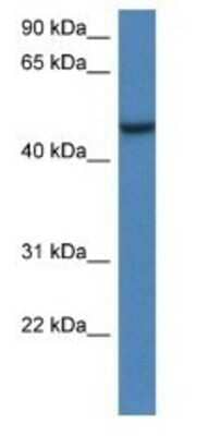 Western Blot: ARMCX1 Antibody [NBP1-79204]