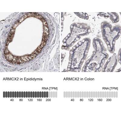 Immunohistochemistry-Paraffin: ARMCX2 Antibody [NBP1-89144]