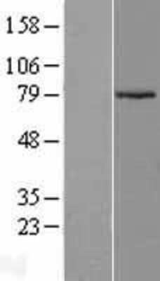 Western Blot: ARMCX2 Overexpression Lysate [NBL1-07714]