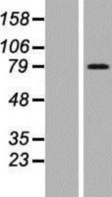 Western Blot: ARMCX2 Overexpression Lysate [NBP2-10040]