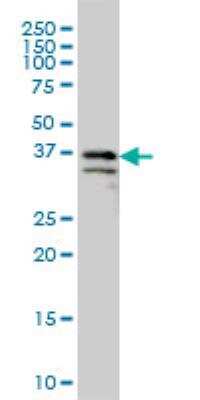 Western Blot: ARMCX3 Antibody (2G3) [H00051566-M01]
