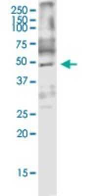 Western Blot: ARMCX3 Antibody (2G3) [H00051566-M01]