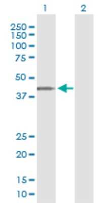 Western Blot: ARMCX3 Antibody (2G3) [H00051566-M01]