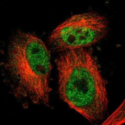 Immunocytochemistry/ Immunofluorescence: ARMCX3 Antibody [NBP1-89142]