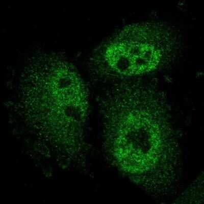 Immunocytochemistry/ Immunofluorescence: ARMCX3 Antibody [NBP1-89142]