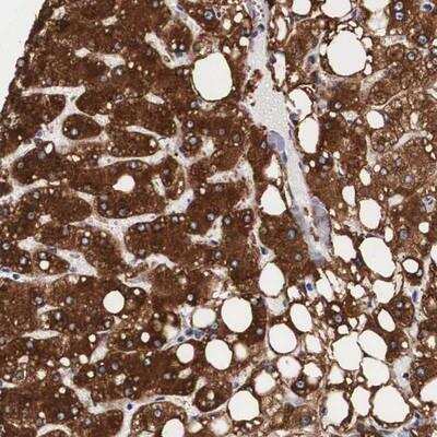 Immunohistochemistry: ARMCX3 Antibody [NBP1-89143]