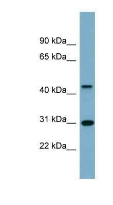 Western Blot: ARMCX3 Antibody [NBP1-62582]