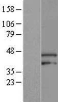 Western Blot: ARMCX3 Overexpression Lysate [NBL1-07716]