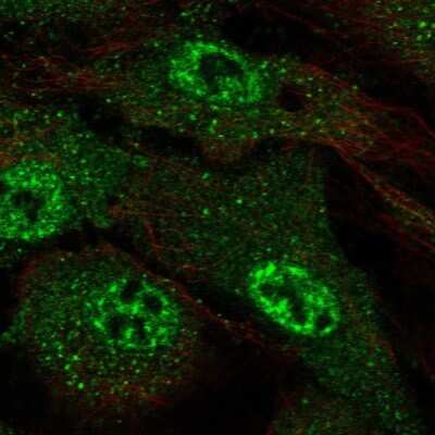 Immunocytochemistry/ Immunofluorescence: ARMCX4 Antibody [NBP2-55337]