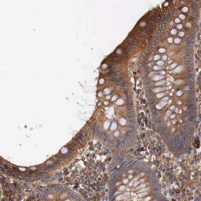 Immunohistochemistry: ARMCX4 Antibody [NBP1-90604]