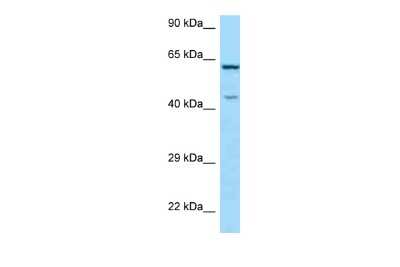 Western Blot: ARMCX5 Antibody [NBP2-84465]