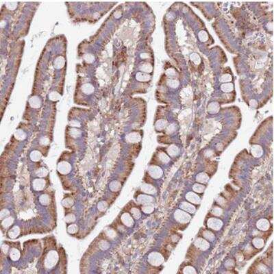 Immunohistochemistry: ARMCX6 Antibody [NBP2-30860]
