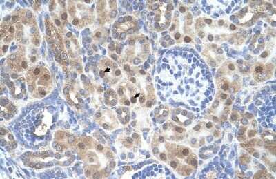 Immunohistochemistry-Paraffin: ARMCX6 Antibody [NBP1-91581]