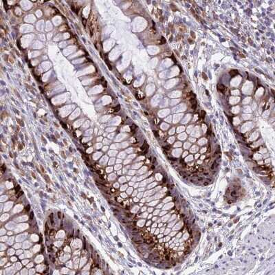 Immunohistochemistry-Paraffin: ARMCX6 Antibody [NBP2-30809]