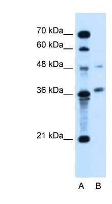 Western Blot: ARMCX6 Antibody [NBP1-91581]