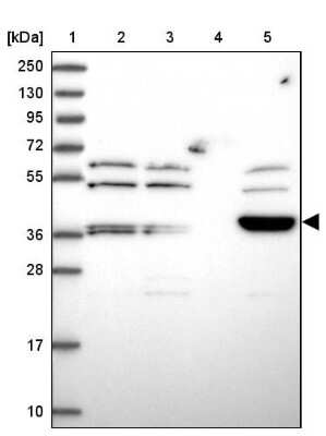 Western Blot: ARMCX6 Antibody [NBP2-30809]