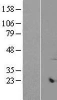 Western Blot: ARMCX6 Overexpression Lysate [NBP2-06749]