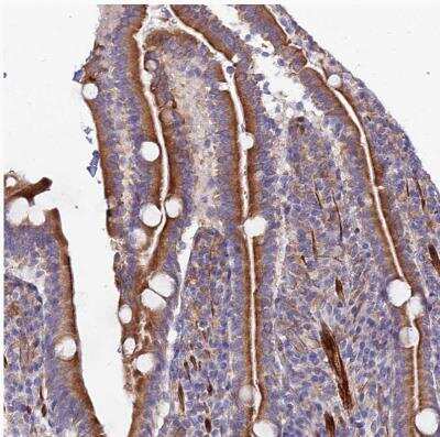 Immunohistochemistry-Paraffin: ARMER Antibody [NBP1-91681]