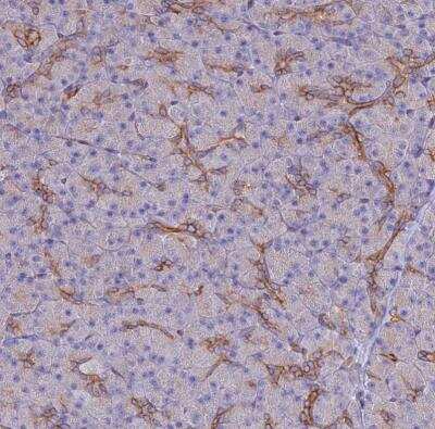 Immunohistochemistry-Paraffin: ARMER Antibody [NBP1-91681]