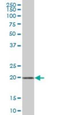 Western Blot: ARMER Antibody [H00023204-B02P]