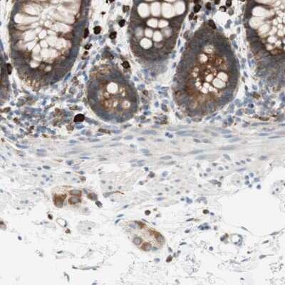 Immunohistochemistry-Paraffin: MANF Antibody [NBP1-90099]
